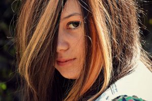 Greffe de cheveux